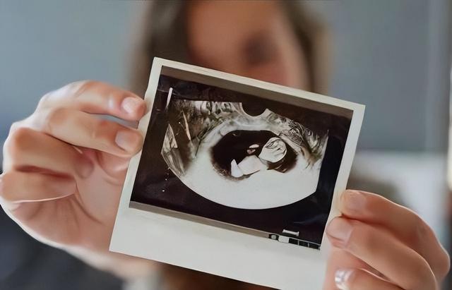  从“弗兰肯斯坦婴儿”到四十八岁母亲：试管婴儿技术四十五年数据复盘与科学审视 健康养生